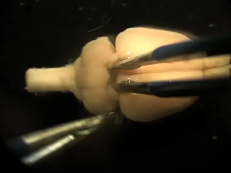 Wholemount المناعية للكشف عن تضاريس دماغية معقدة