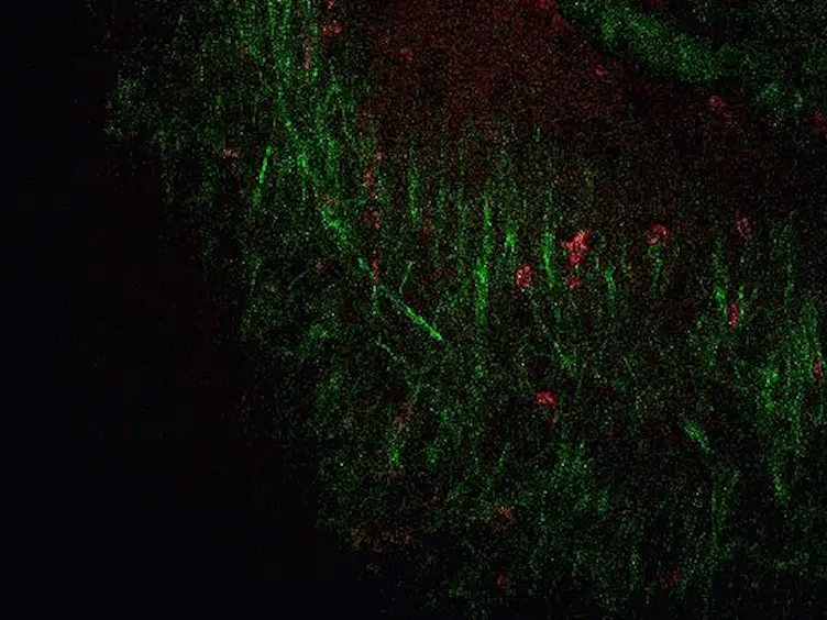 Visualizing Angiogenesis by Multiphoton Microscopy In Vivo in Genetically Modified 3D-PLGA/nHAp Scaffold for Calvarial Critical Bone Defect Repair