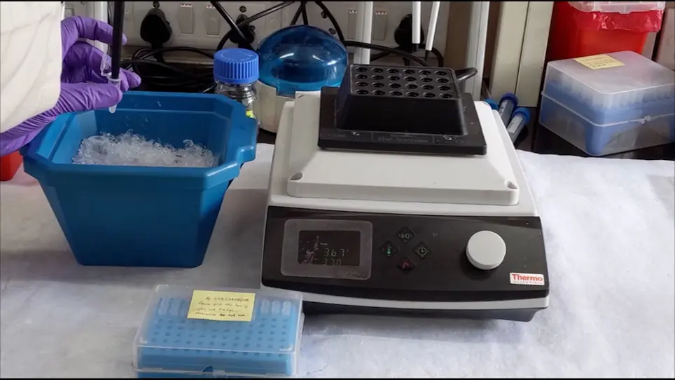 Flusso di lavoro di proteomica quantitativa utilizzando il rilevamento basato sul monitoraggio di reazioni multiple di proteine dal tessuto cerebrale umano