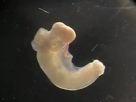 Récupération des ovocytes de souris