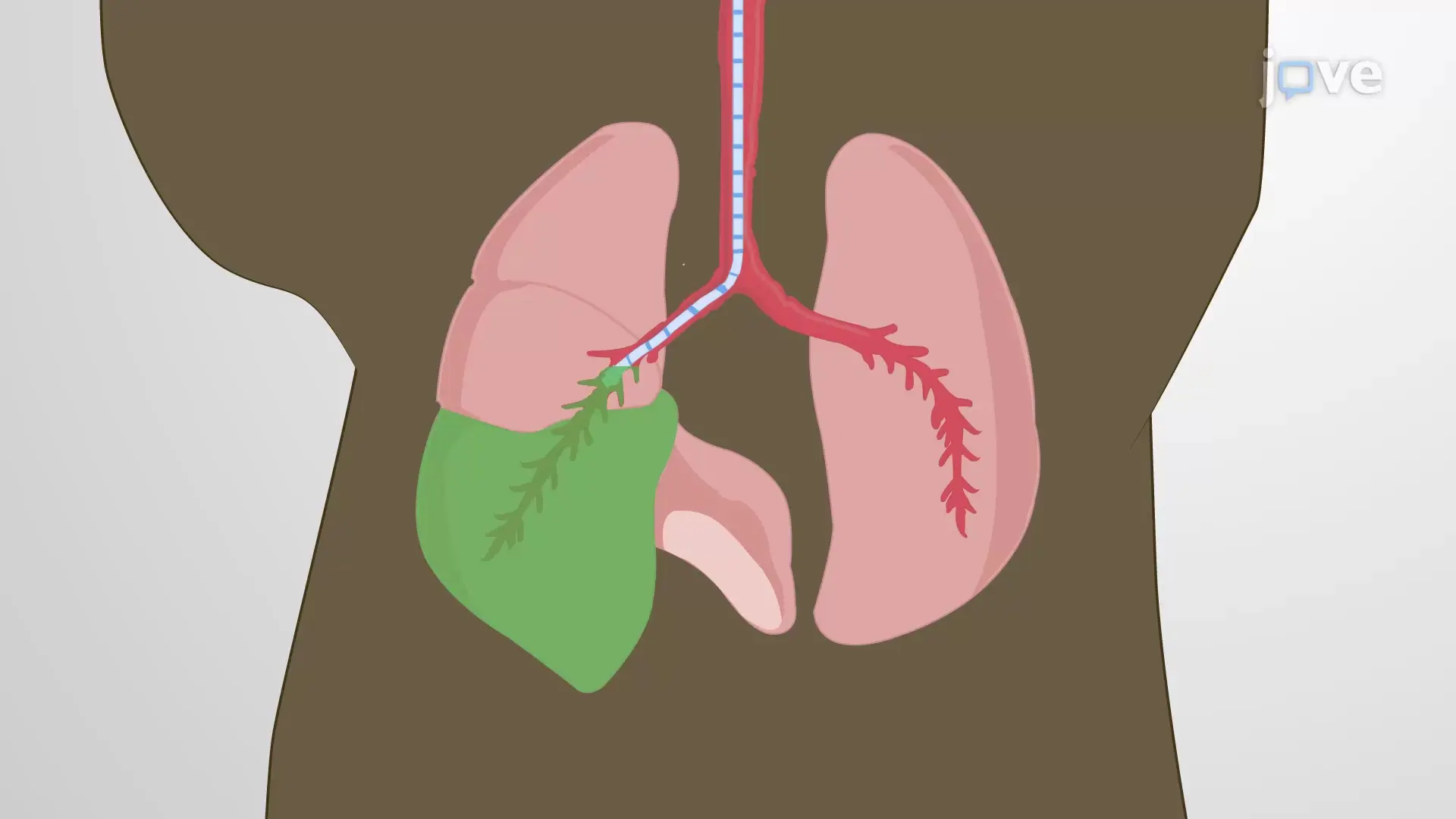 Administration intrabronchique : technique d’administration sélective d’un agent expérimental dans un poumon de souris