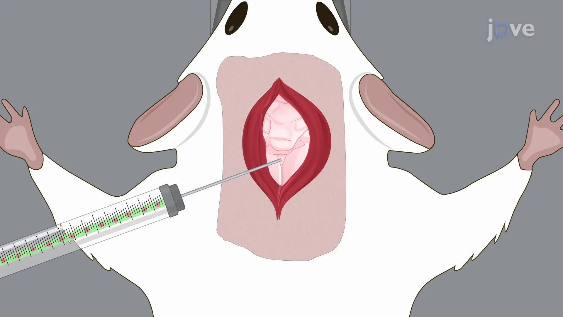 Surgical Cisterna Magna Injection: A Method for Administering Tumor Cells Directly into Central Nervous System of Murine Model