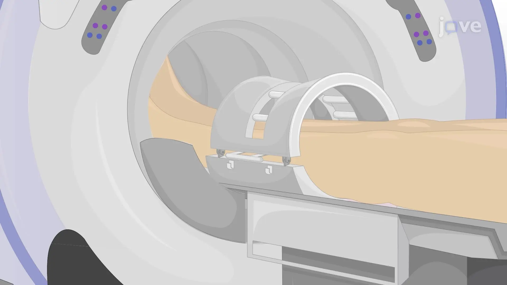 Using 23Na Magnetic Resonance Imaging to Measure Sodium in Muscle Tissues