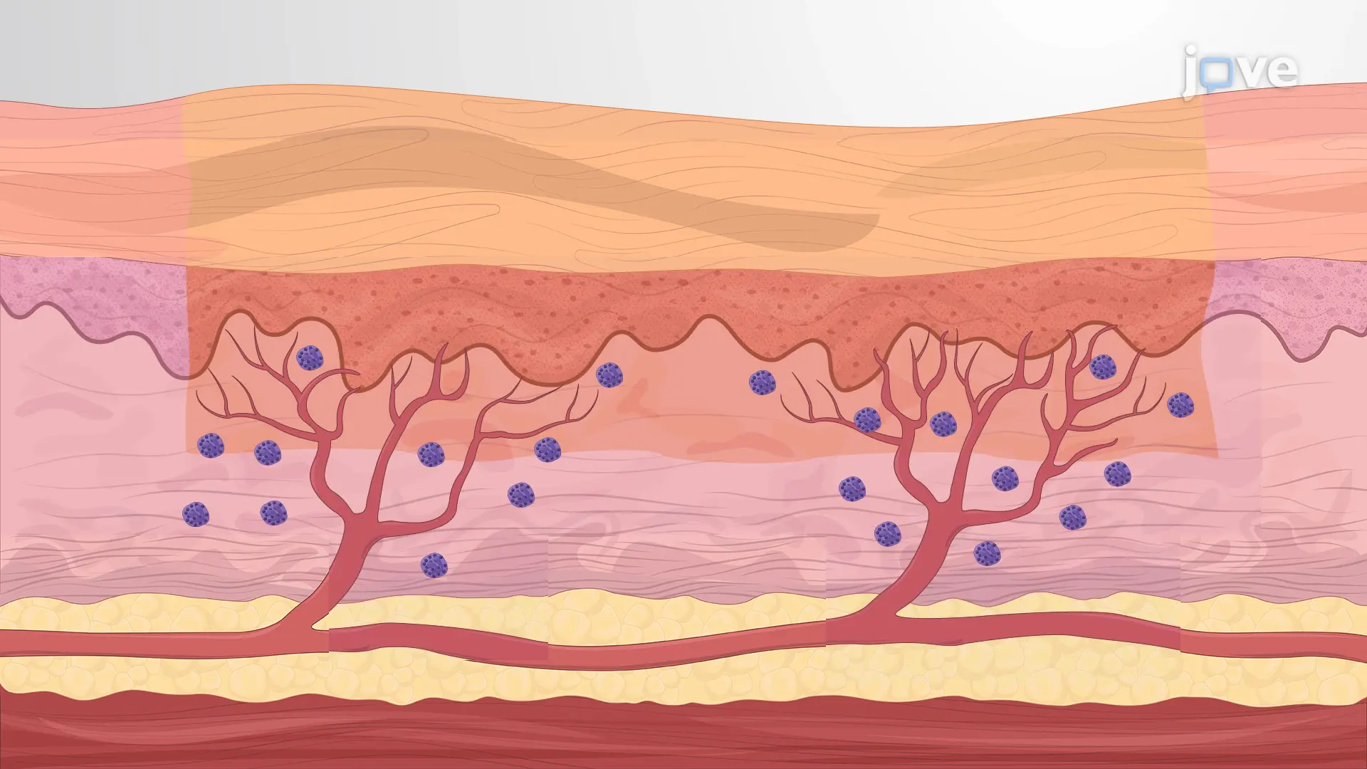 A Technique for Human Skin Grafting in a Mouse Model