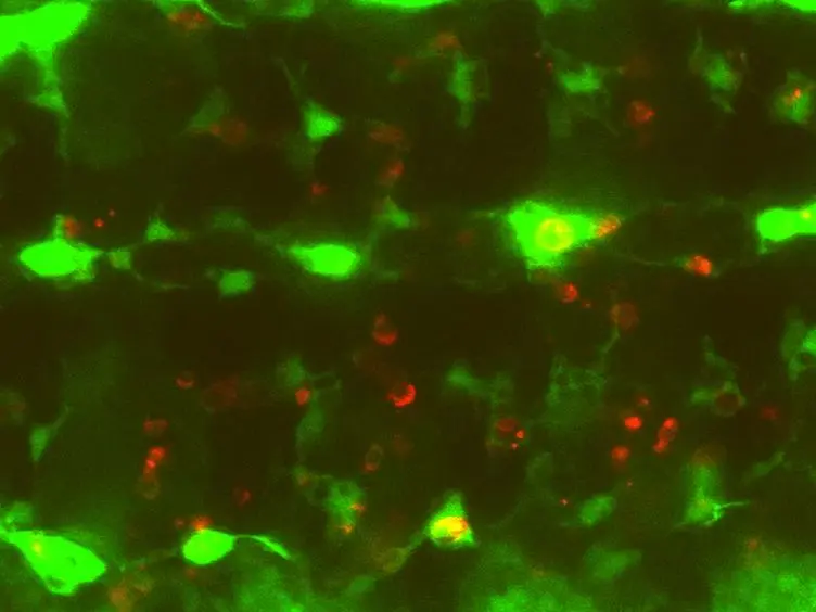 Imagens ao vivo de Apuramento celular por apoptose durante