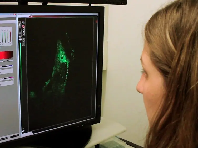 Visualizzazione dei G3BP stress Granuli Dynamics in cellule primarie in diretta