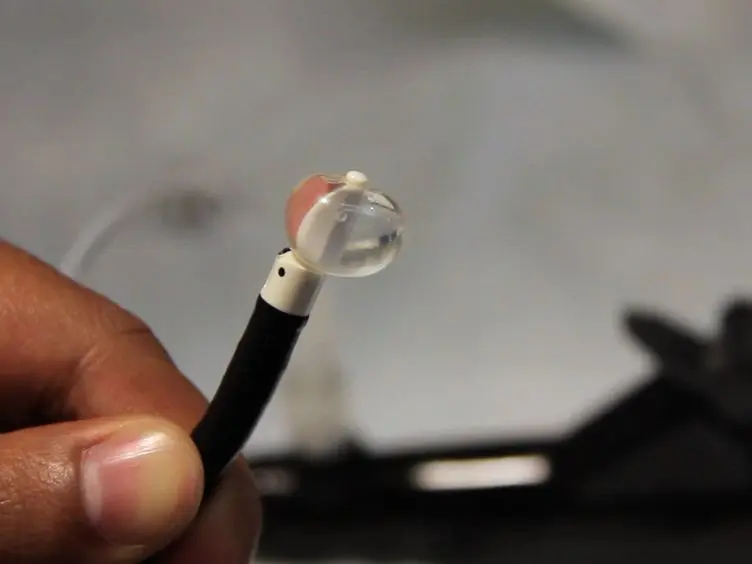 Substernal Tireóide Biópsia Usando endobrônquica guiada por ultrassom transbrônquica Punção Aspirativa por Agulha