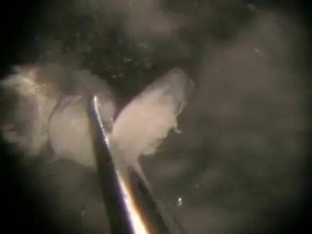 Dissezione di ovaie Drosophila