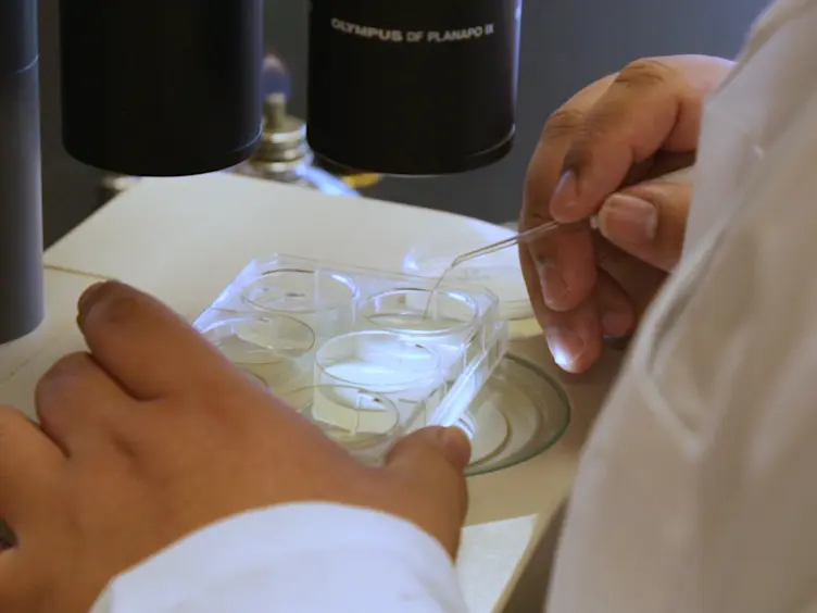 O Canal de Excretory c. elegans como modelo para intracelular Lumen morfogênese e Vivo na biogênese de membrana polarizada em uma única célula: rotulagem por GFP-fusões, tela de interação de RNAi e Imaging