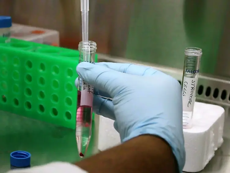 Isolamento de células do estroma Endometrial humanas para In Vitro Decidualization