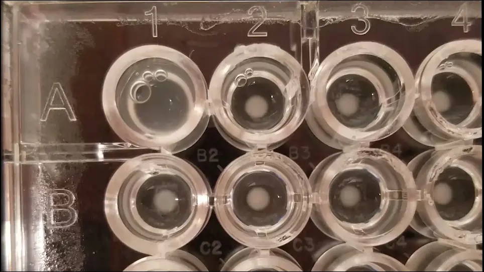 Imagem ao vivo de alta taxa de microcolônias para medir heterogeneidade no crescimento e expressão genética