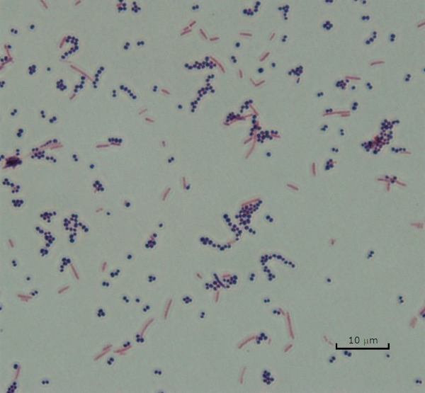 klebsiella pneumoniae capsule stain 100x