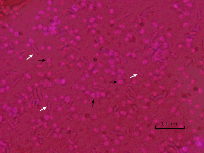 klebsiella pneumoniae capsule stain