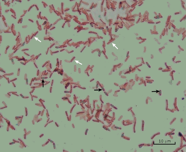 Staphylococcus aureus morphology visualised using Gram staining (10×