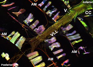 Figure 1a