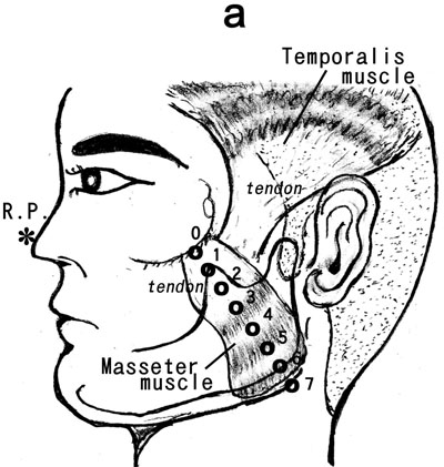 Figure 1 a