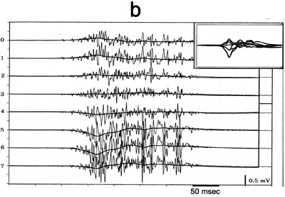 Figure 1 b