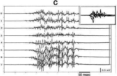 Figure 1c