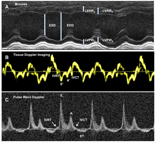 Transthoracic Echocardiography in Mice (artículo) | JoVE