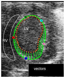 Figure 1 II