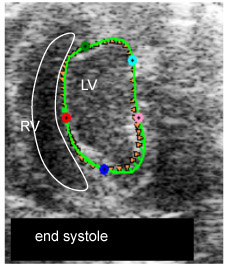 Figure 1 III