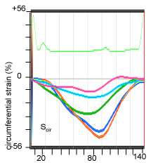 Figure 1 VI