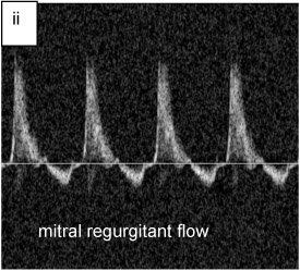 Figure 3 II