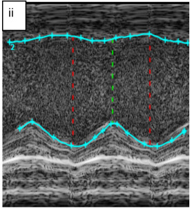 Figure 4 II