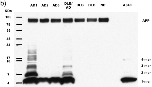 Figure 1b