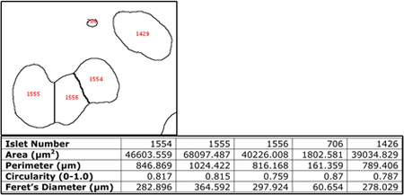 figure 1d