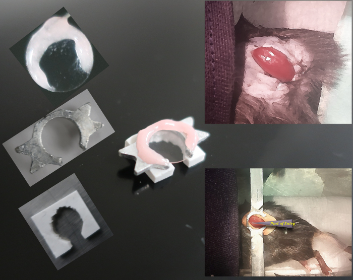 figure-results-1 Orthodontic device for dental correction, featuring 3D modeling and dental fitting simulation.