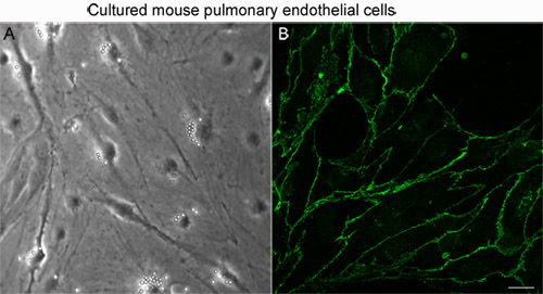 figure-protocol-1 Mouse pulmonary endothelial cells; microscopy image; cell culture visualization; fluorescence analysis.