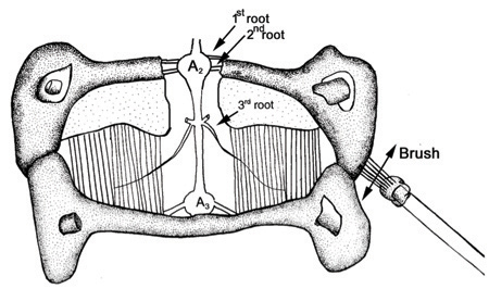 Figure 32