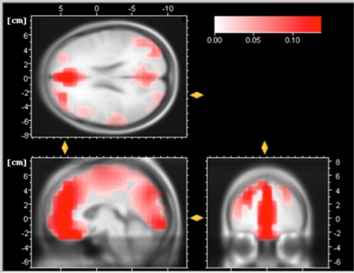 Figure 3a