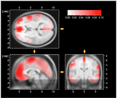 Figure 3b