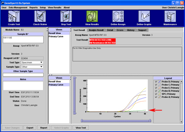 Figure 1B