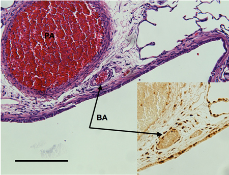 Figure 2A