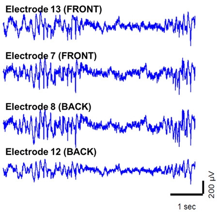 Figure 13