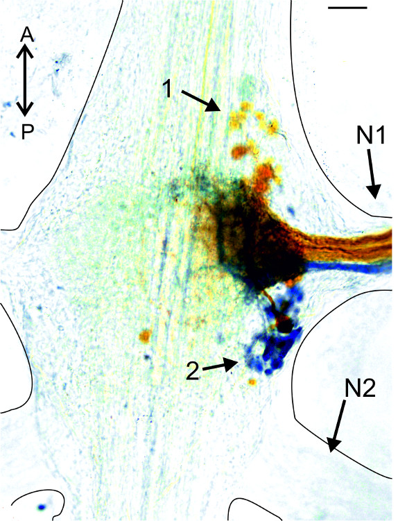 Figure 22