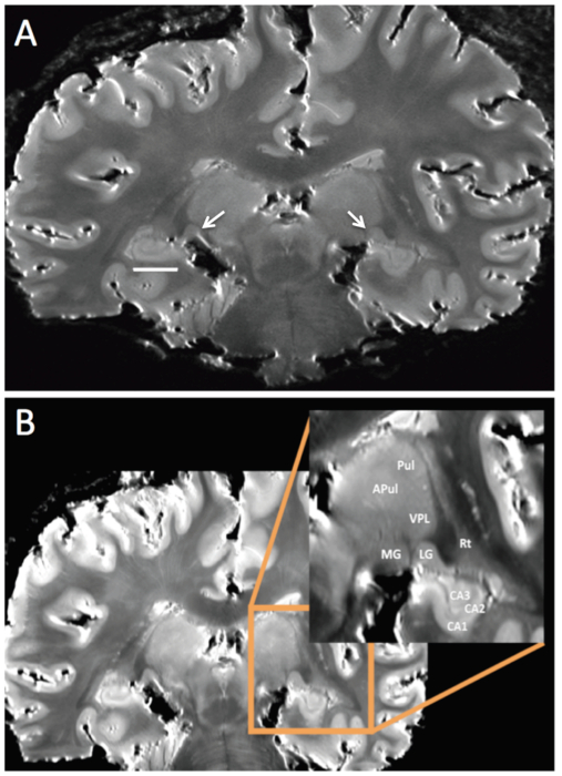 Figure 6