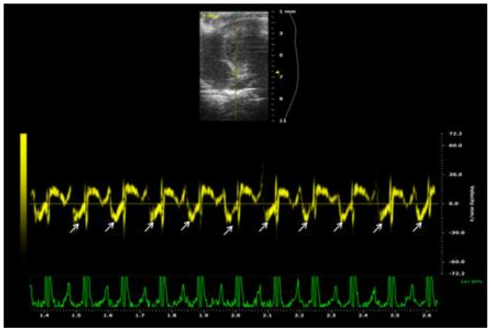 Figure 11