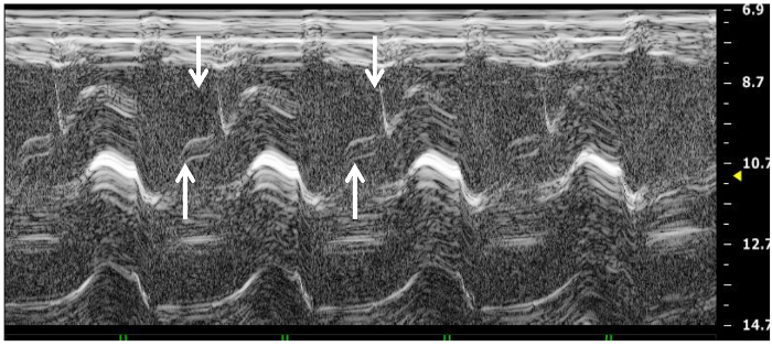 Figure 7