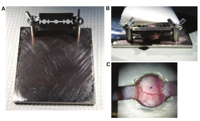 Figure 1