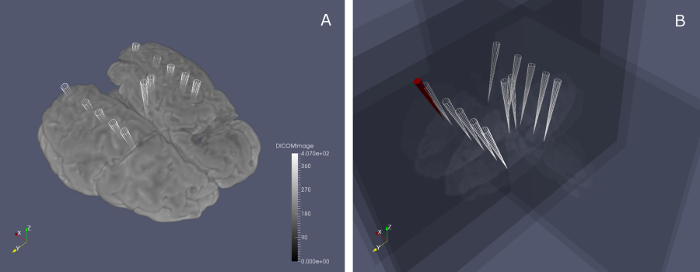 Figure 10