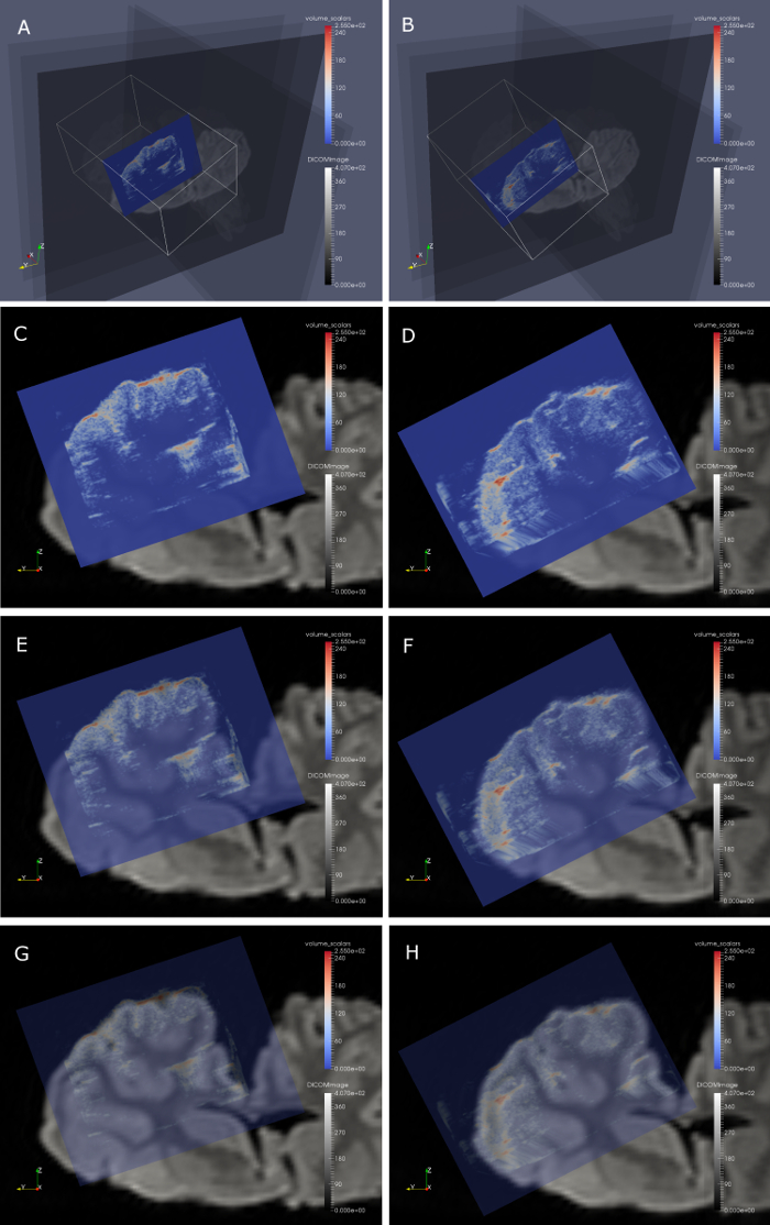 Figure 18