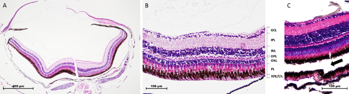 Figure 11