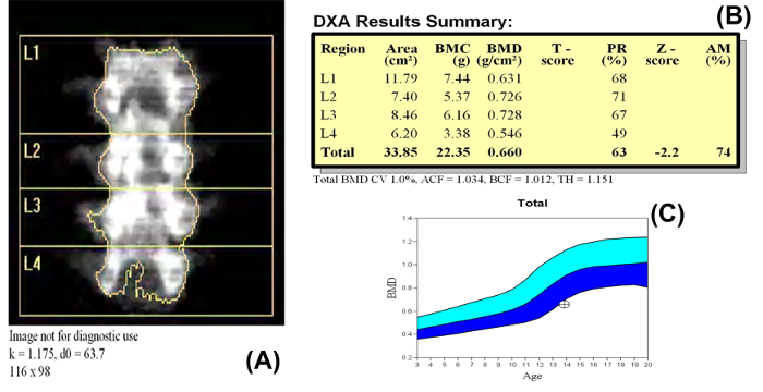 Figure 11