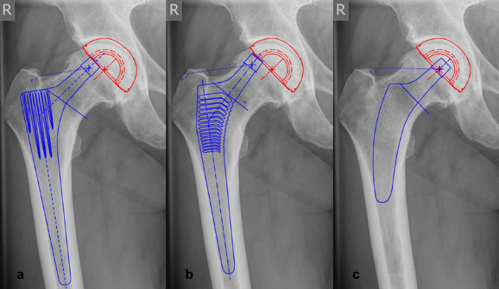 Figure 10