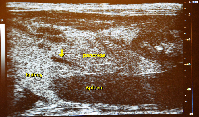 Figure 14