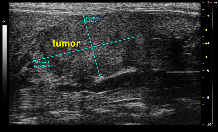 Figure 20